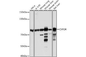 Western blot analysis of extracts of various cell lines, using CYPOR Rabbit mAb (ABIN7269151) at 1:1000 dilution. (POR 抗体)