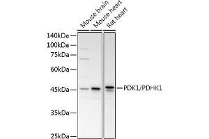 Western blot analysis of extracts of various cell lines, using PDK1/PDHK1 antibody (ABIN3015351, ABIN3015352, ABIN1681301, ABIN5663787 and ABIN6214001) at 1:1000 dilution.