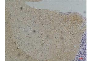 Immunohistochemistry (IHC) analysis of paraffin-embedded Mouse Brain Tissue using KV1. (Kv1.1 Potassium Channel 抗体)