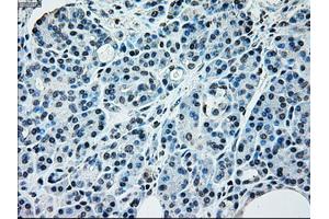 Immunohistochemical staining of paraffin-embedded pancreas tissue using anti-NRBP1mouse monoclonal antibody. (NRBP1 抗体)