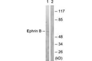 Western blot analysis of extracts from 293 cells, treated with EGF 200ng/ml 5', using EFNB1/2 (Ab-330) Antibody. (EFNB1/2 (AA 284-333) 抗体)