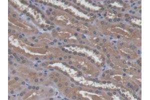 Immunohistochemistry (IHC) image for anti-alpha 1, 4-Galactosyltransferase (A4GALT) (AA 44-353) antibody (ABIN7444748)