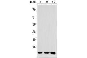 Western blot analysis of CCL26 expression in HEK293T (A), NS-1 (B), H9C2 (C) whole cell lysates. (CCL26 抗体  (Center))