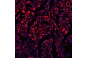 IF analysis of TRMT6 using anti-TRMT6 antibody (ABIN7602138). (TRMT6 抗体  (AA 6-489))