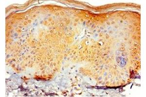 Immunohistochemistry of paraffin-embedded human skin tissue using ABIN7151129 at dilution of 1:100 (RNF125 抗体  (AA 1-232))