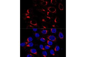Immunofluorescence analysis of HeLa cells using USO1 antibody (ABIN7271235) at dilution of 1:200 (60x lens). (USO1 抗体  (AA 663-962))