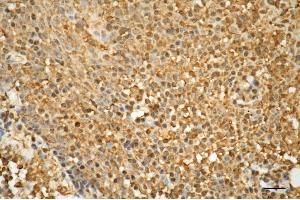 Immunohistochemistry was performed on paraffin-embedded human tonsillitis using CD86 antibody (ABIN7797986), 1:100).