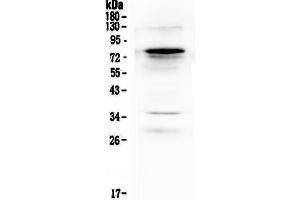 Western blot analysis of Complement C9 using anti-Complement C9 antibody . (C9 抗体  (AA 289-515))