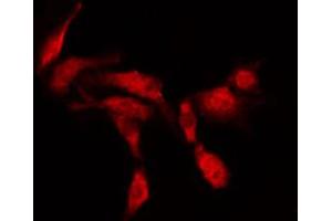 ABIN6266651 staining MDA-MB-435 by IF/ICC. (NCOR1 抗体  (N-Term))