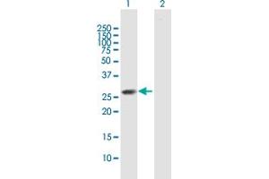 Western Blot analysis of CLTB expression in transfected 293T cell line by CLTB MaxPab polyclonal antibody. (CLTB 抗体  (AA 1-211))