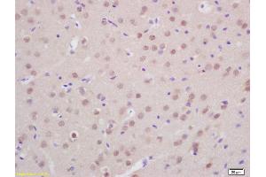 Formalin-fixed and paraffin embedded rat brain labeled with Anti-Prox1 Polyclonal Antibody, Unconjugated (ABIN680503) at 1:200 followed by conjugation to the secondary antibody and DAB staining (PROX1 抗体  (AA 151-250))