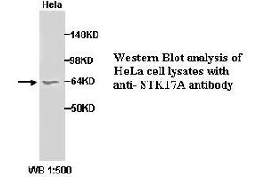 Image no. 1 for anti-serine/threonine Kinase 17a (STK17A) (C-Term) antibody (ABIN790926) (STK17A 抗体  (C-Term))