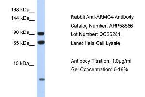 Western Blotting (WB) image for anti-Armadillo Repeat Containing 4 (ARMC4) (N-Term) antibody (ABIN2787749) (ARMC4 抗体  (N-Term))