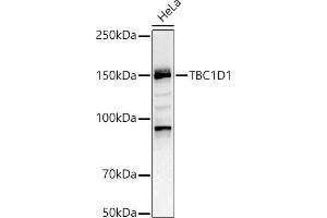 Western Blotting (WB) image for anti-TBC1 (Tre-2/USP6, BUB2, Cdc16) Domain Family, Member 1 (TBC1D1) (AA 520-710) antibody (ABIN6148878)