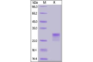 SDS-PAGE (SDS) image for CD8a Molecule (CD8A) (AA 22-182) (Active) protein (His tag,AVI tag,Biotin) (ABIN6973023)