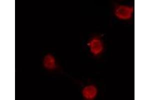 ABIN6274167 staining HuvEc cells by IF/ICC.