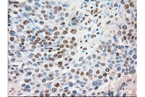 Immunohistochemical staining of paraffin-embedded Kidney tissue using anti-SIGLEC9mouse monoclonal antibody. (SIGLEC9 抗体)