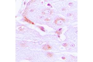 Immunohistochemical analysis of CABC1 staining in human brain formalin fixed paraffin embedded tissue section. (COQ8A 抗体  (Center))
