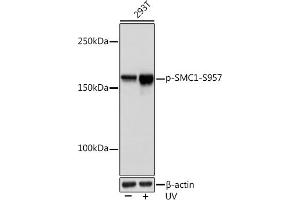 Western blot analysis of extracts of 293T cells, using Phospho-SMC1-S957 Rabbit mAb (ABIN7270613) at 1:1000 dilution. (SMC1A 抗体  (pSer957))