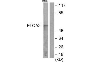 Western blot analysis of extracts from COLO cells, using ELOA3 antibody.