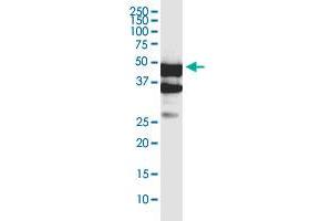 SERTAD4 monoclonal antibody (M02), clone 3G11. (SERTAD4 抗体  (AA 1-356))