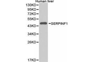 Western Blotting (WB) image for anti-serpin Peptidase Inhibitor, Clade F (Alpha-2 Antiplasmin, Pigment Epithelium Derived Factor), Member 1 (SERPINF1) antibody (ABIN1874740) (PEDF 抗体)