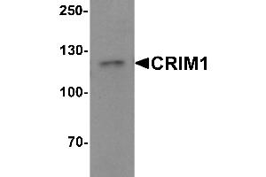 Western blot analysis of CRIM1 in Jurkat cell lysate with Crim1 antibody at 1 µg/mL. (CRIM1 抗体  (C-Term))