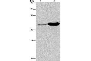 Western blot analysis of Mouse liver and brain tissue, using GLUL Polyclonal Antibody at dilution of 1:650 (GLUL 抗体)