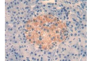 Detection of IL4 in Human Pancreas Tissue using Monoclonal Antibody to Interleukin 4 (IL4) (IL-4 抗体  (AA 25-153))
