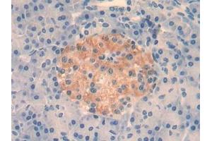 Detection of IL4 in Human Pancreas Tissue using Monoclonal Antibody to Interleukin 4 (IL4)