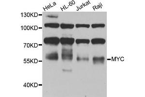 Western blot analysis of extracts of various cells, using MYC antibody. (c-MYC 抗体)