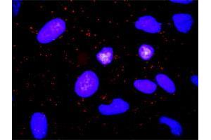 Proximity Ligation Analysis of protein-protein interactions between TGFA and ADAM17. (TGFA 抗体  (AA 1-160))
