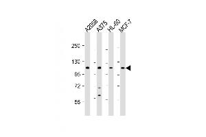 Western Blotting (WB) image for anti-Collagen, Type XVII, alpha 1 (COL17A1) (AA 475-504) antibody (ABIN653043)