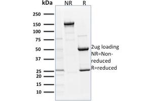 SDS-PAGE Analysis Purified p63 Mouse Monoclonal Antibody (TP63/1786). (p63 抗体  (AA 3-106))