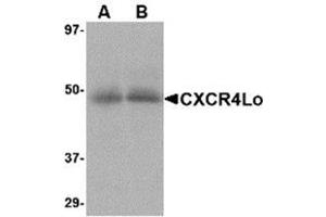 Western blot analysis of CXCR4 in (A) human spleen and (B) human thymus tissue lysate with AP30268PU-N CXCR4-Lo antibody at 10 μg/ml. (CXCR4 抗体  (Isoform A, N-Term))