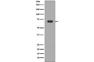 Western blot analysis of Alas1 expression in HepG2 cell lysate. (Recombinant ALAS1 抗体)