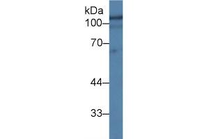 Detection of HEXb in Human Hela cell lysate using Polyclonal Antibody to Hexosaminidase B Beta (HEXb) (HEXB 抗体  (AA 122-311))