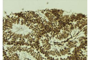 ABIN6273696 at 1/100 staining Mouse testis tissue by IHC-P. (SETDB2 抗体  (N-Term))