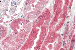 ABIN185675 (5µg/ml) staining of paraffin embedded Human Kidney. (VHL 抗体  (Internal Region))
