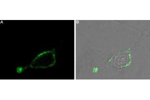 Expression of Adenylate cyclase type III in rat U-87 MG cells - Cell surface detection of Adenylate cyclase type III in intact living rat U-87 MG cells.