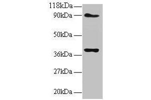 Western blot All lanes: NDUFS5 antibody at 2 μg/mL Lane 1: EC109 whole cell lysate Lane 2: 293T whole cell lysate Secondary Goat polyclonal to rabbit IgG at 1/15000 dilution Predicted band size: 13 kDa Observed band size: 40 kDa (NDUFS5 抗体  (AA 2-106))