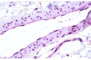 Human, Vascular Endothelium: Formalin-Fixed Paraffin-Embedded (FFPE) (S1PR1 抗体  (Cytoplasmic Domain))