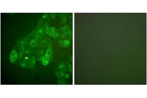 Immunofluorescence analysis of A549 cells, using Connexin 43 Antibody. (Connexin 43/GJA1 抗体  (AA 333-382))