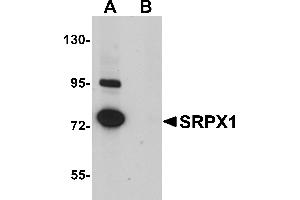 Western Blotting (WB) image for anti-Sushi-Repeat Containing Protein, X-Linked (SRPX) (N-Term) antibody (ABIN1031585) (SRPX 抗体  (N-Term))