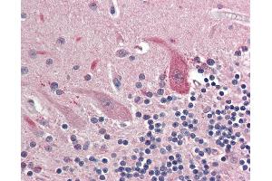 Anti-OSMR antibody IHC staining of human brain, cerebellum. (Oncostatin M Receptor 抗体  (AA 612-661))
