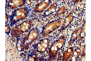 Immunohistochemistry of paraffin-embedded human small intestine tissue using ABIN7162833 at dilution of 1:100 (FKBP3 抗体  (AA 2-224))