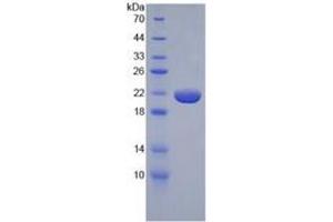 SDS-PAGE of Protein Standard from the Kit (Highly purified E. (TNF alpha ELISA 试剂盒)