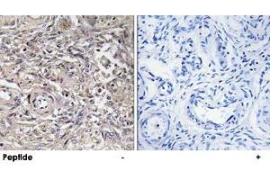 Immunohistochemistry analysis of paraffin-embedded human ovary tissue using CLDN6 polyclonal antibody . (Claudin 6 抗体)