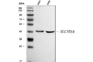 Western blot analysis of SLC35E4 using anti-SLC35E4 antibody (ABIN7599299).