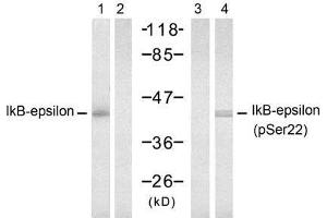 Western blot analysis of extract from 293 cells, untreated or treated with TNF-α (20ng/ml, 15min), using IkB-ε (Ab-22) antibody (E021296, Lane 1 and 2) and IkB-ε (Phospho-Ser22) antibody (E011213, Lane 3 and 4). (NFKBIE 抗体)